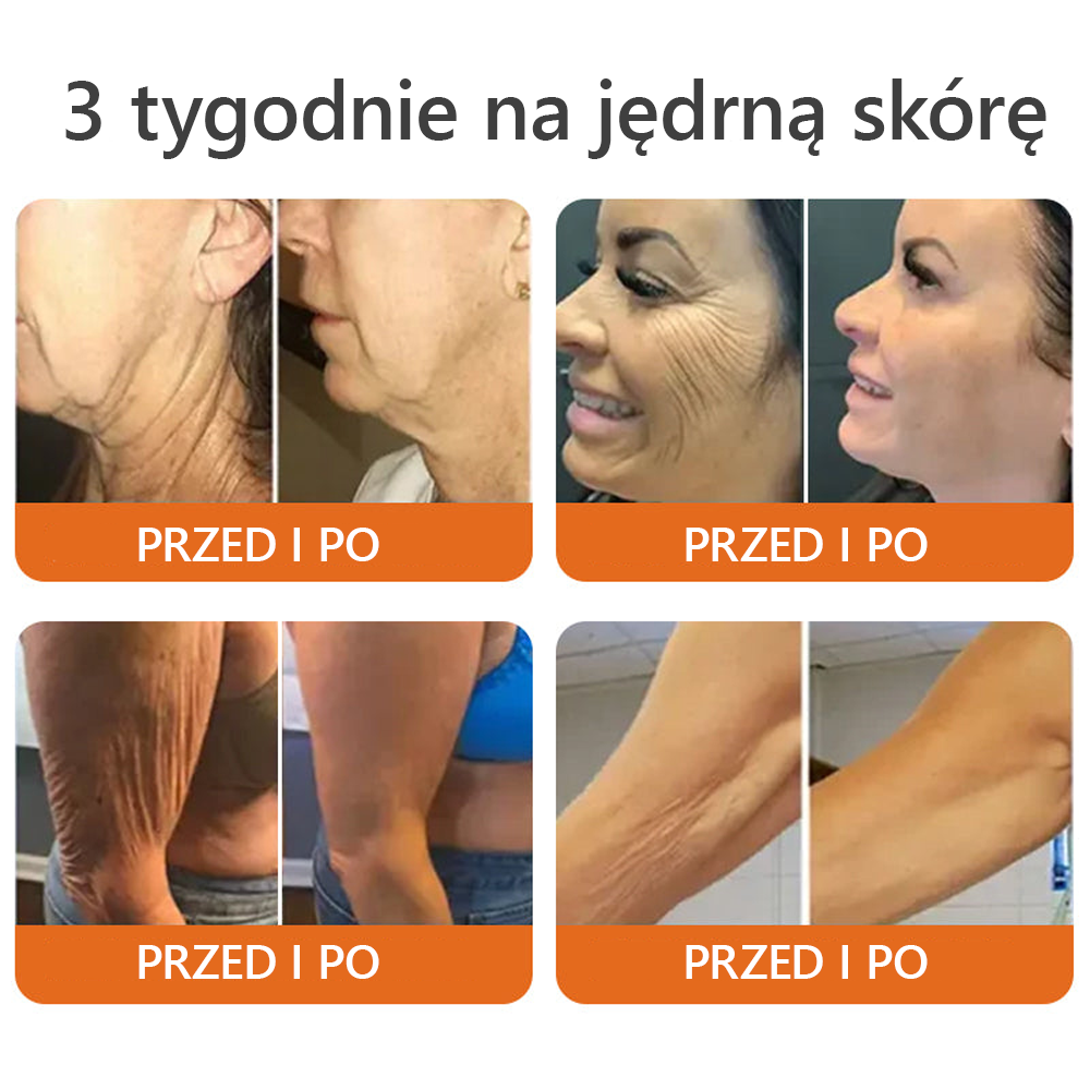 𝐖𝐲𝐩𝐫𝐨𝐝𝐮𝐤𝐨𝐰𝐚𝐧𝐨 𝐢 𝐰𝐲𝐬ł𝐚𝐧𝐨 𝐳 𝐏𝐨𝐥𝐬𝐤𝐢🍃𝐃𝐨𝐫𝐦𝐨𝗿𝗻𝗮® 𝐉𝐚𝐝 𝐏𝐬𝐳𝐜𝐳𝐞𝐥𝐢 𝐤𝐨𝐦𝐩𝐥𝐞𝐤𝐬𝐨𝐰𝐲 𝐤𝐫𝐞𝐦🌟𝑶𝑺𝑻𝑨𝑻𝑵𝑰 𝑫𝒁𝑰𝑬Ń 80% 𝒁𝑵𝑰Ż𝑲𝑰🔥🔥